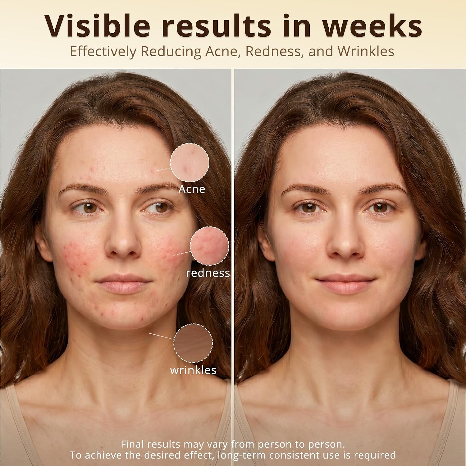 Helps explain light placement, coverage, and the mask’s build quality.