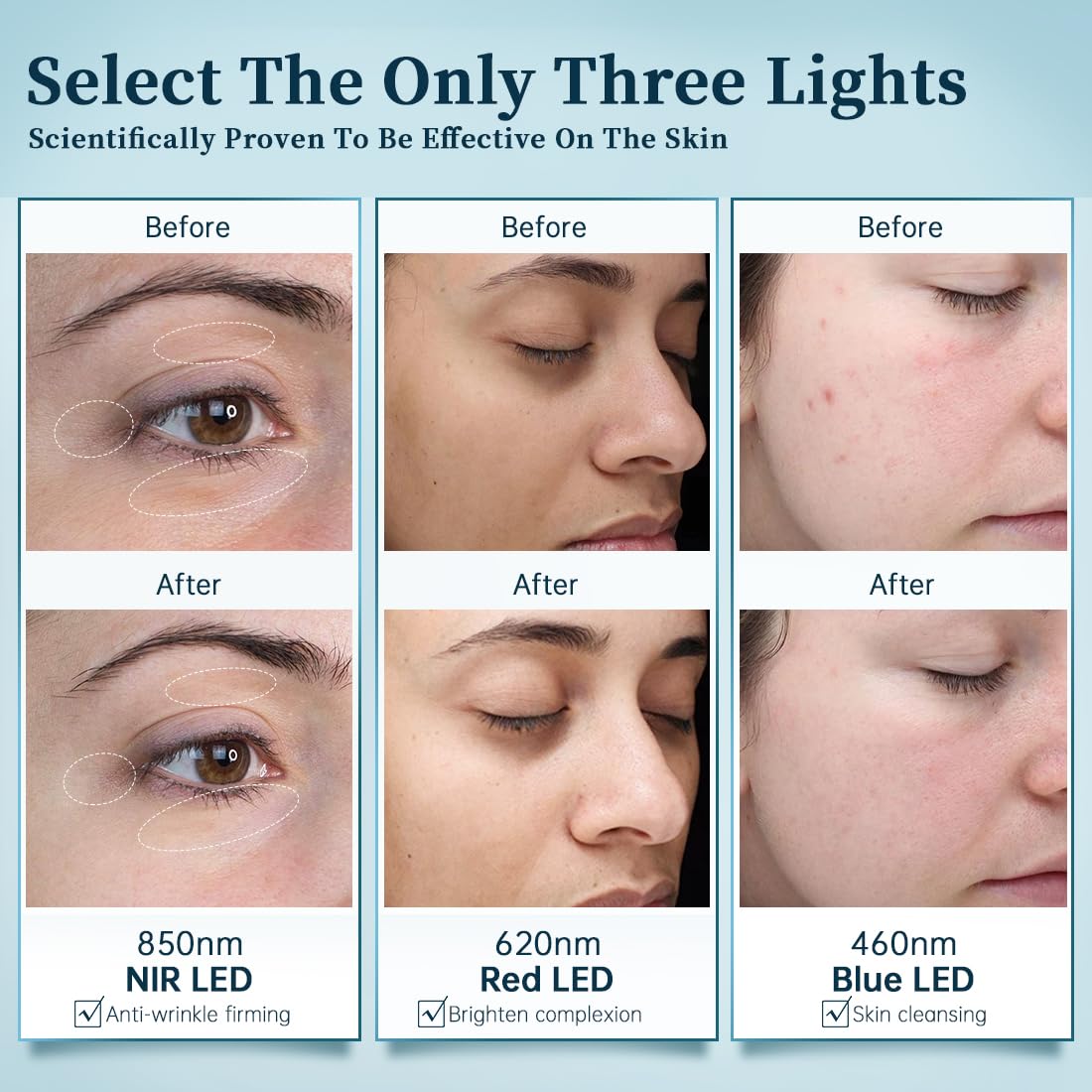 8-Color LED Face Mask Light Therapy, Cloud-Sss Rb-081