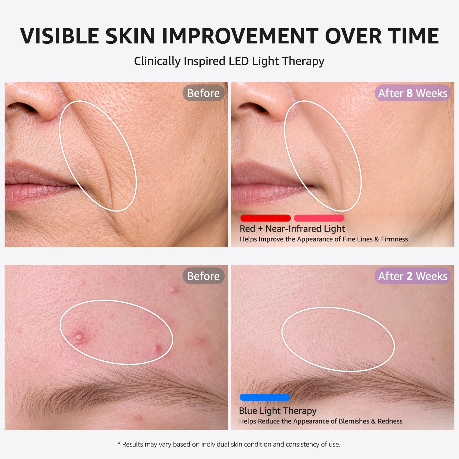 Form factor, full-contour coverage, and how the mask conforms to face and neck areas.